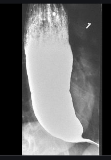 Esame Radiografico Esofago